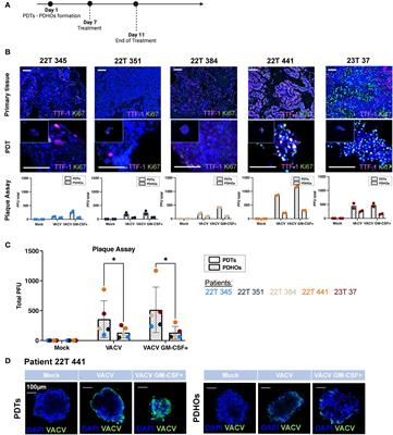 Patient-derived tumoroids and proteomic signatures: tools for early drug discovery